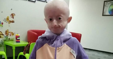 Benjamin Button Hikayesi Gerçek Oldu! 10 Yaşındaki Çocuk Yaşlılıktan Öldü