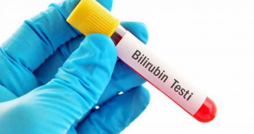 Bilirubin Nedir, Bilirubin Yüksekliği Ve Düşüklüğünün Sebepleri Nelerdir?