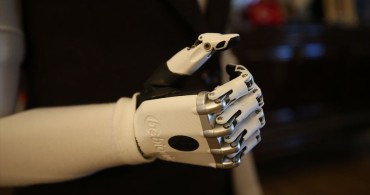 Biyonik Kollarla Hayata Tutunan Sevim Nur Türkmen'in Hikayesi