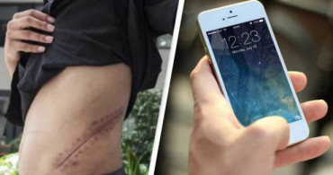 Böbreğini Satıp iPhone Alan Genç Hayatını Yatalak Geçirecek