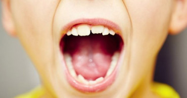 Çocuklarda Ağız İçi Yaraları Nasıl İyileşir? Bitkisel Tedavi Yöntemleri Nelerdir?