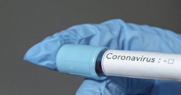 Covid19 İmmun Plasma Ve Tedavisi Onaylandı! Kök Hücre İse Yolda