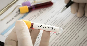 DNA testi için gelmişlerdi: 186 milyon liralık miras aldılar