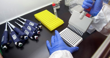 Dünya Sağlık Örgütü: Ebola Virüsü İçin Acil Durum Yok 