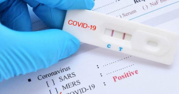 Dünya'da İlk Kez Görüldü! Kovid-19'un Yeni Belirtisi
