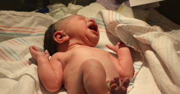 Epidural (Ağrısız) Normal Doğum Nedir?