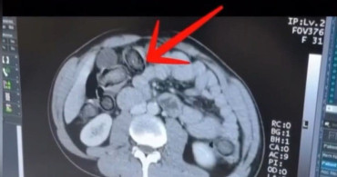 Erzincan'da uyuşturucu operasyonu: 983 gram metamfetamin yakalandı