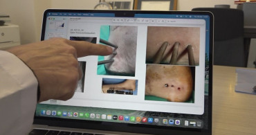 Eskişehir'de Dünyanın İlk Enfeksiyonlu Ortamlara Uygun Yapay Kemik Geliştirildi