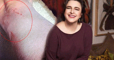 Esra Dermancıoğlu'nun Hastalığı Nedir?