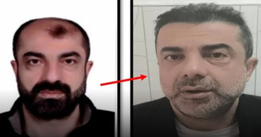 Estetikle Yüzünü Değiştirip Kaçan Firari Zanlı Yakalandı