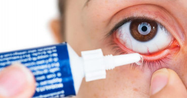 Göz Nezlesi (Konjuktivit) Nedir?