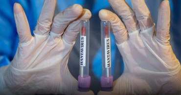 Hantavirüs Şüphesiyle Getirilen Türk Vatandaşlarının Testleri Negatif Çıktı