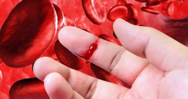 Hemofili hastalığı tedavi yönteminde dikkat edilmesi gereken yöntemler!