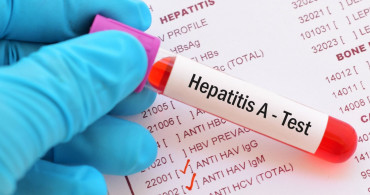 Hepatit A Neden Olur, Nasıl Geçer?