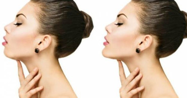 Jawline Çene Dolgusu Nedir?