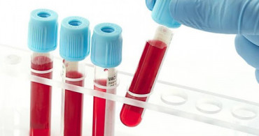 Kadınların Hayatını Kurtaracak 5 Test