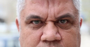 Kahramanmaraş'ta 3 Renkli Gözleriyle Dikkat Çeken Mehmet Eser