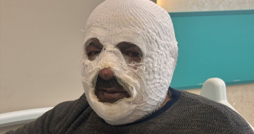 Kalorifer Kazanında Benzinle Yaşanan Kaza: 54 Yaşındaki Adam Yangın Kurbanı Oldu