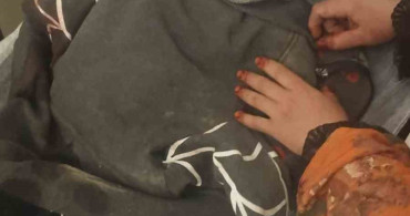 Kayseri'de Köpek Saldırısı: 3 Yaşındaki Çocuk Ağır Yaralandı