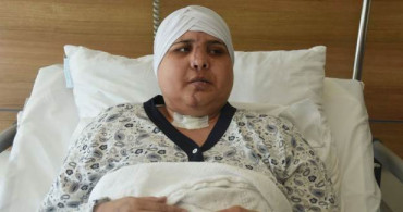 Kazada İkiye Ayrılan Yüzünü 10 Saatlik Ameliyatla Birleştirdiler