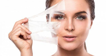 Kimyasal Peeling Ne İşe Yarar?