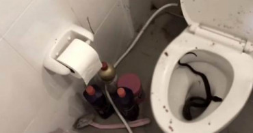 Klozetten Çıkan Yılan Gencin Cinsel Organını Isırdı
