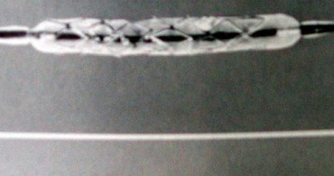 Koroner Kalp Hastalığı İçin Saç Teli Kalınlığında Stent Geliştirildi