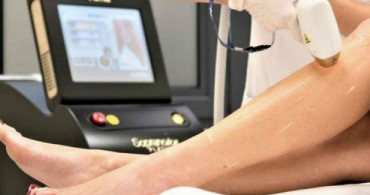 Lazer Epilasyon Nedir? Lazer Epilasyon Çeşitleri Nelerdir?