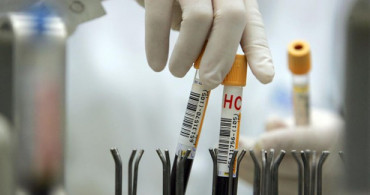 MCH Nedir? 