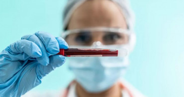 MCHC kan tahlili nedir, neden istenir? MCHC hangi durumlarda artar? MCHC yüksekliği ve düşüklüğünün etkileri