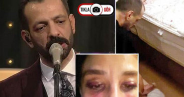 Özer Arkun’un 35 Yıla Kadar Hapisle Cezalandırılması Talep Edildi