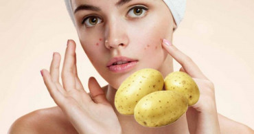 Patates Maskesi