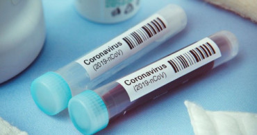 Sağlık Bakanlığı Açıkladı! Coronavirüs İçin 14 Gün Kuralı