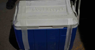 Samsun'da Organ Bağışı Hayat Kurtardı