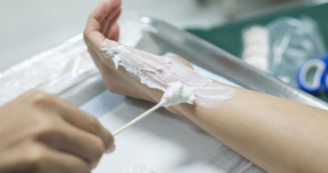 Silverdin Krem Nedir? Silverdin Krem Nerelerde Kullanılır? Silverdin Kremin Fiyatı