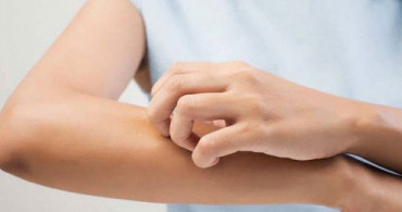 Sivrisineklere Elma Sirkesi ile Savaş Açın