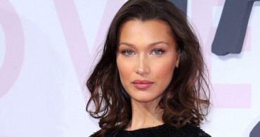 Supermodel Estetik Ameliyatı İddialarına Cevap Verdi