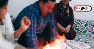 TikTok Videosu Uğruna Eşinin Ellerini Yaktı