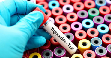 Trigliserid Nasıl Düşürülür?
