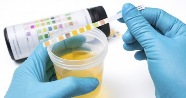 Uzman Uyarısı: İdrardaki Proteinin Miktarı Önemli