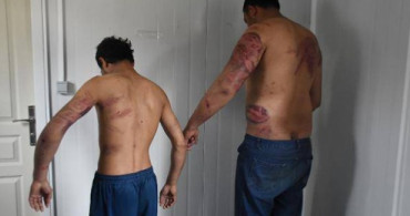 Yunan Polisi Yakaladıkları İki Göçmeni Feci Şekilde Dövüp Türkiye'ye Gönderdi