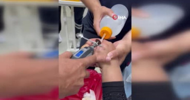 Yüzüğü parmağına sıkışan kadının yardımına itfaiye ekipleri koştu