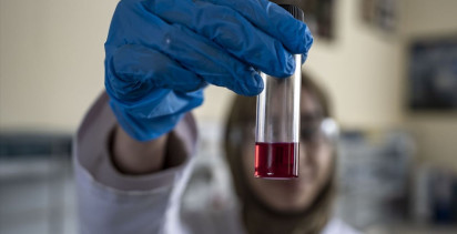 Atatürk Üniversitesi, İlaç Ham Maddesi Üretiminde Öncü Oluyor