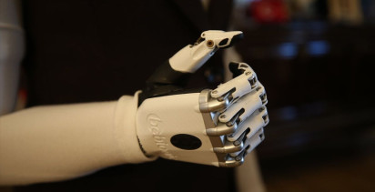 Biyonik Kollarla Hayata Tutunan Sevim Nur Türkmen'in Hikayesi