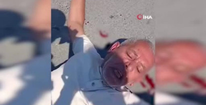 Motosikletli Zabıta Seyyar Satıcıya Çarptı