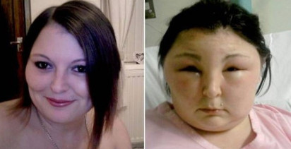 Saçını Boyadı: Kör Oldu! İyileşmesi Aylar Sürecek...