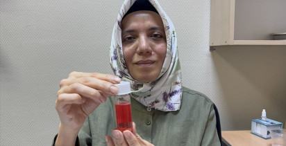 Süleyman Demirel Üniversitesi Göz Bankası'nın Başarılı Kornea Nakilleri