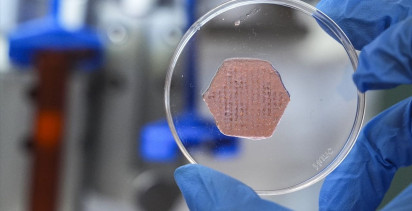 Yeni Nesil Yara Örtüsü İzmir'den Umut Oluyor