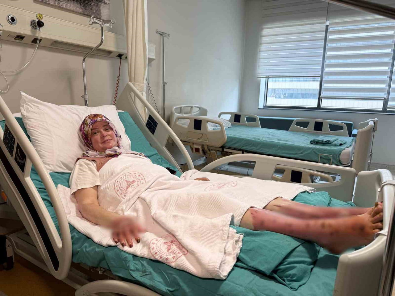 45 YAŞINDAKİ ŞEHRİ KOCAMAN'IN VÜCUDUNUN YÜZDE 70’İ YANDI.