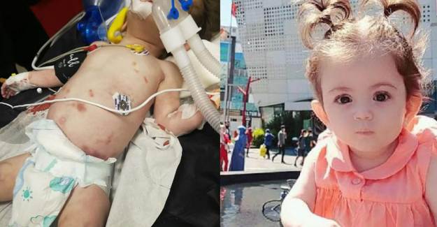 1 Yaşındaki Bebek, Ailesi Tarafından İşkenceyle Öldürüldü